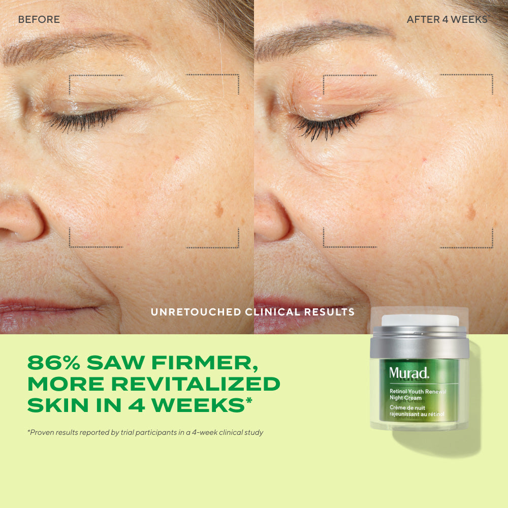 Active Renewal Regimen 90-Day Kit - Image 4