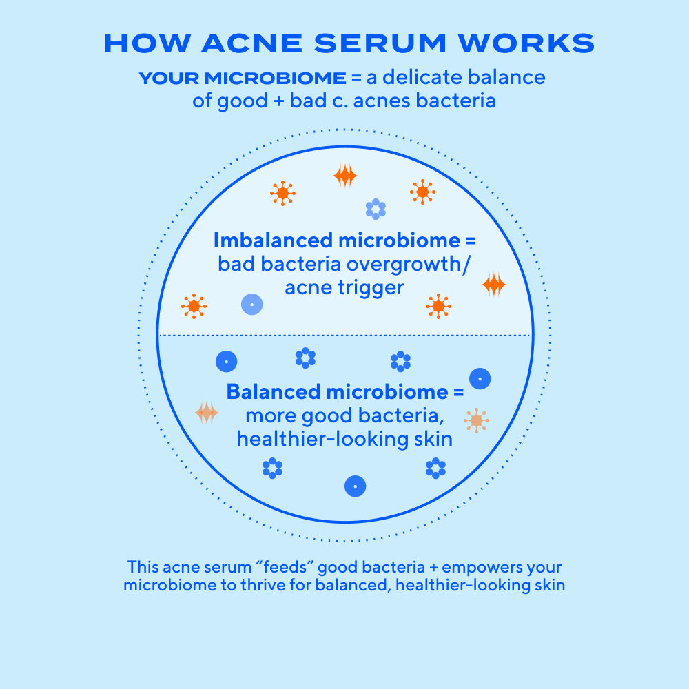 Clear Skin Acne Discovery Kit - Image 10